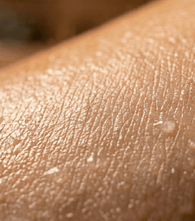 Close up van de huid van een arm in een sauna